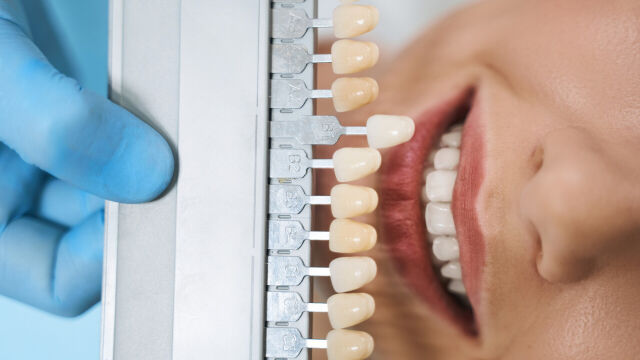 Czy implanty stomatologiczne są dla każdego?